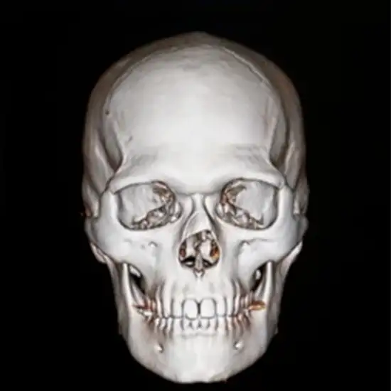 Non-Contrast CT (NCCT) Face Test